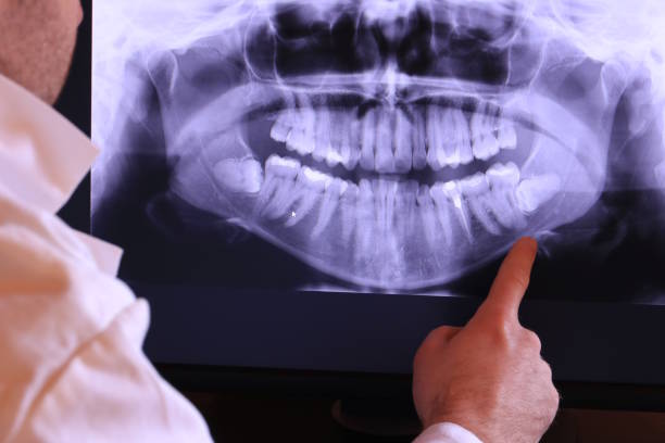 Best Emergency Root Canal Treatment in Smackover, AR